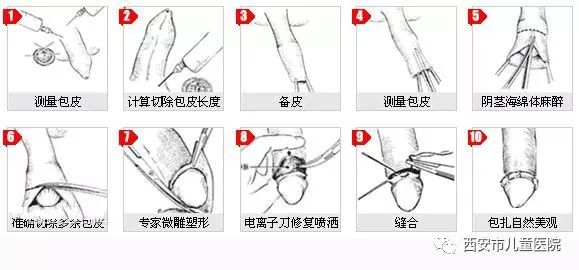 包皮手术的医院有哪些