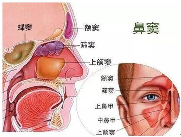 鼻窦炎有哪些症状用什么药治疗