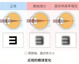 眼涩眼干用什么药