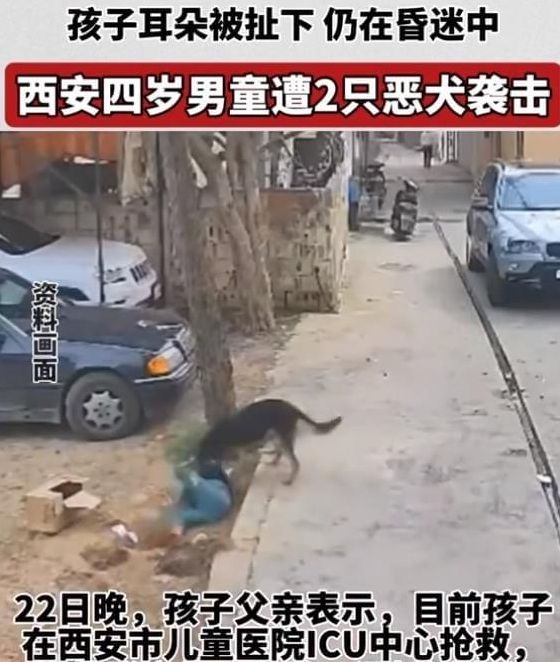 西安4岁男童遭恶犬袭击致昏迷