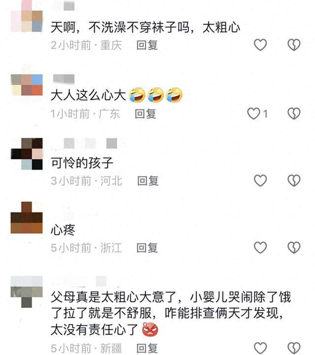 女婴两天哭闹不止竟头发丝绕脚趾