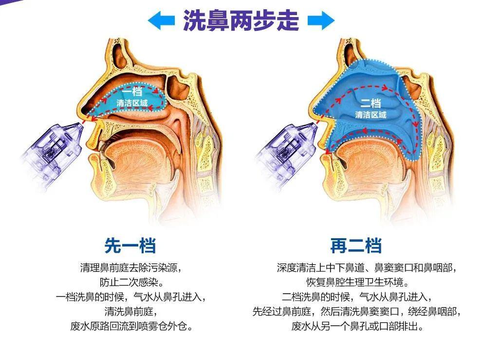 如何防治人偏肺病毒感染高发